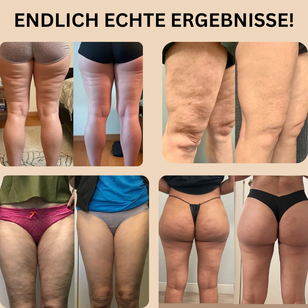 3D Anti-Cellulite Leggings