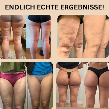 3D Anti-Cellulite Leggings